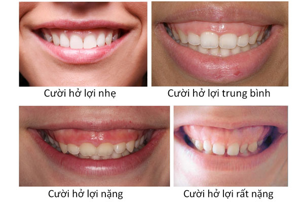 Nha khoa Hải Phòng