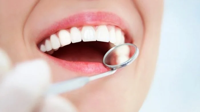 Thẩm mỹ răng sứ tại kim môn