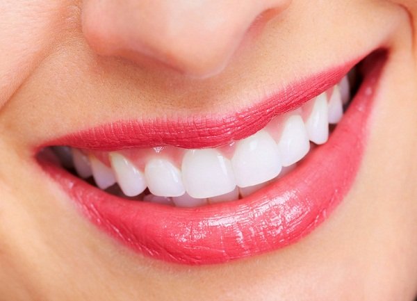 Thẩm mỹ răng sứ tại Kim Thành